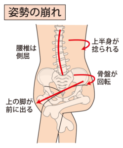 産後以外でも骨盤矯正が必要なパターン10